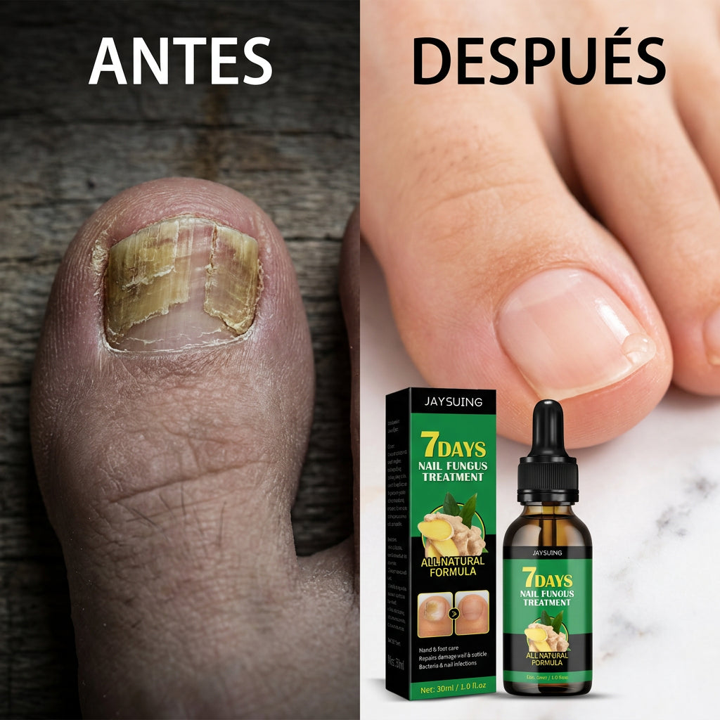 Anti Hongos Uñas - 7 Days™ 3